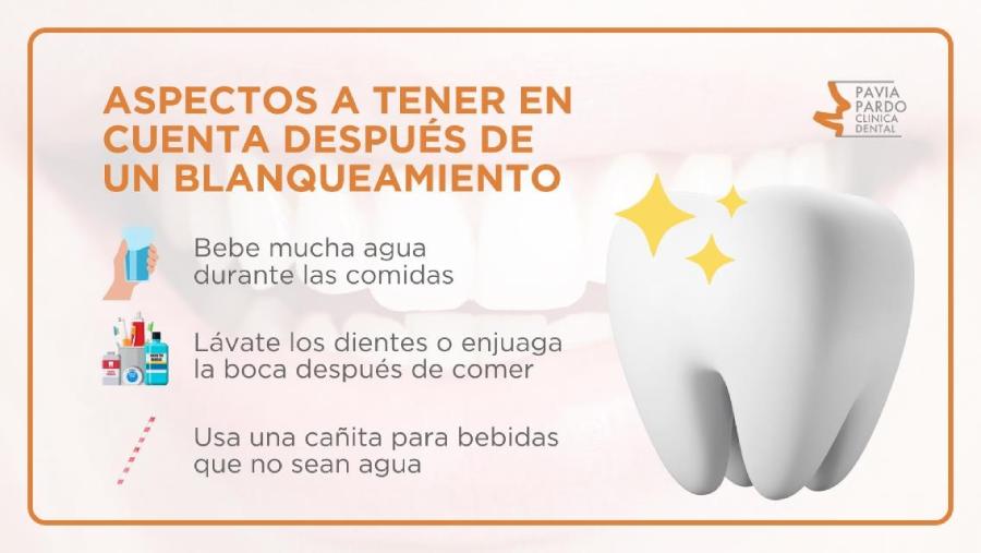 aspectos a tener en cuenta en blanqueamiento dental